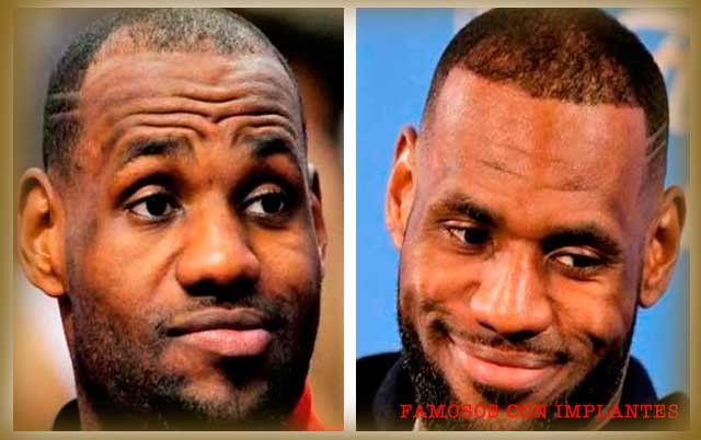 LEBRON-JAMES