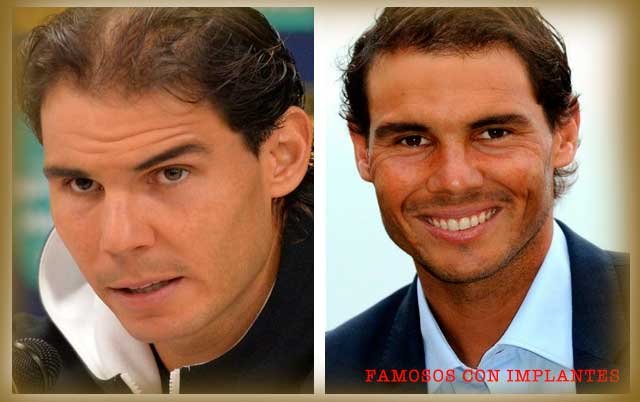 RAFA-NADAL